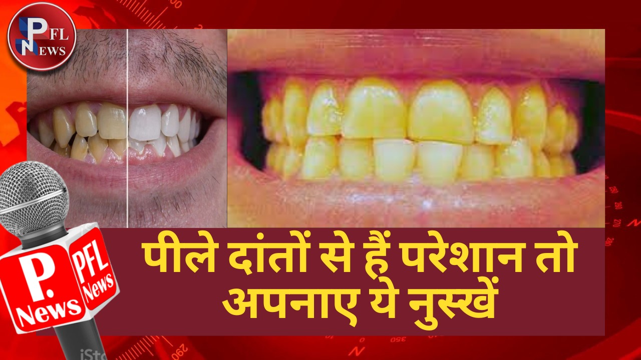 PFL News - पीले दांतों से हैं परेशान तो अपनाए ये नुस्खें