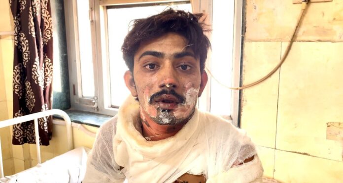 PFL News - अजमेर में युवक पर पेट्रोल छिड़क लगाई आग, मौत, मरने से पहले बनाया वीडियो PFL News - अजमेर में युवक पर पेट्रोल छिड़क लगाई आग, मौत, मरने से पहले बनाया वीडियो